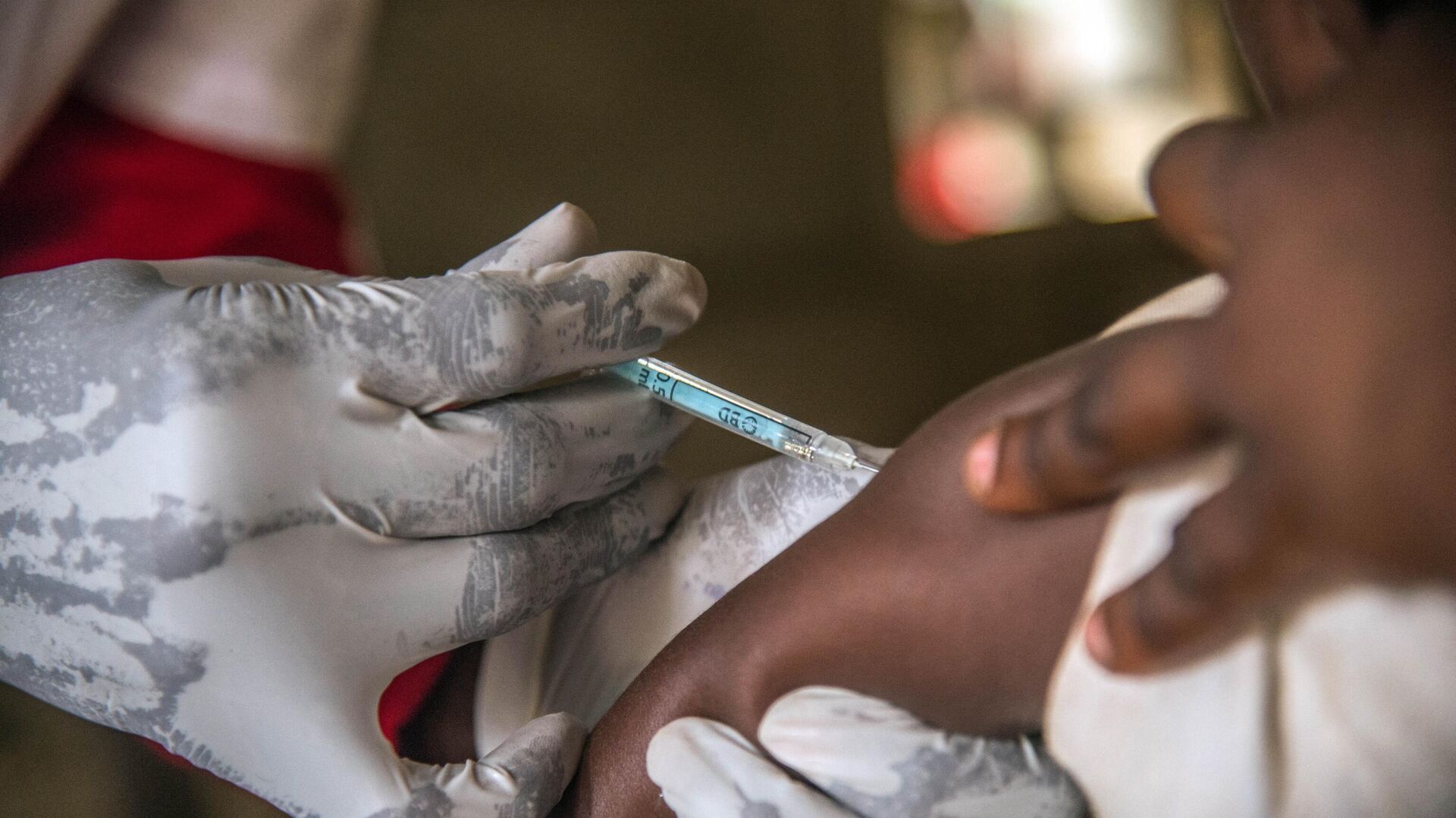 Uganda Confirms Measles in Refugee Camps