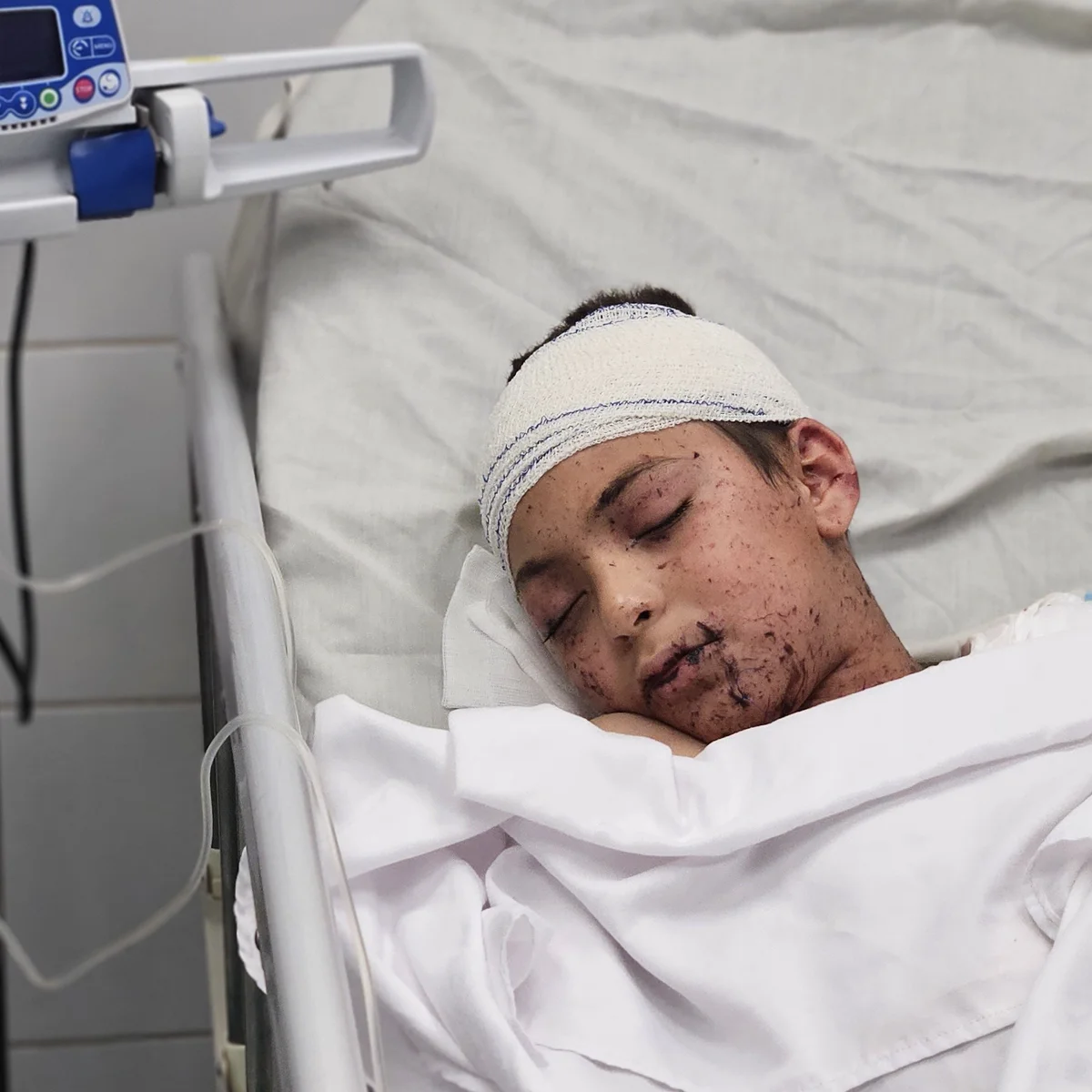 Palestinian Father Dies from Injuries After Israeli Air Strike Killed Nine of His Children